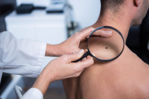 skin cancer screening near me